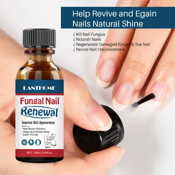 Lak za tekoče Nail repair tekočino Odstraniti sivo nohte 10 ml za nego nohtov glive nohtov Essence nail olje za nohte Essence
